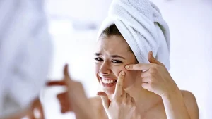 Can stress cause acne? Experts explain the science behind the skin-mind connection