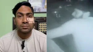 Delhi Cop Thrashed With Baseball Bat After Argument, receives 5 Stiches Near Eye