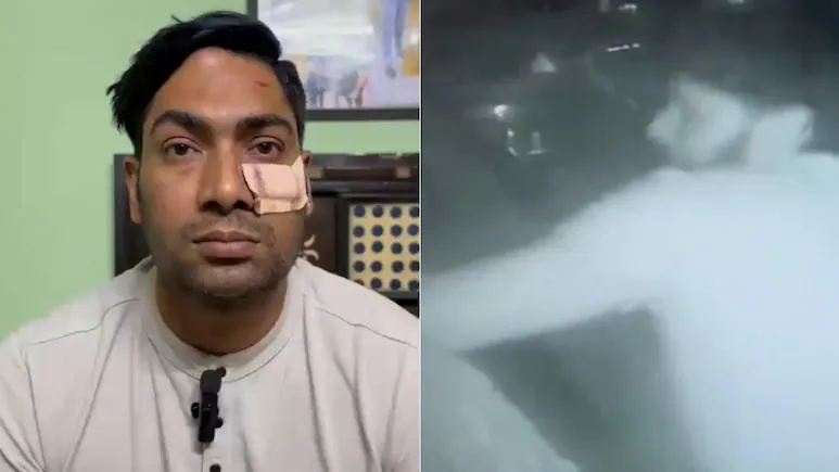 Delhi Cop Thrashed With Baseball Bat After Argument, receives 5 Stiches Near Eye