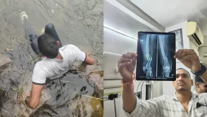 Man Jumps 30 Feet Into Dam For Reel, Fractures Both Legs