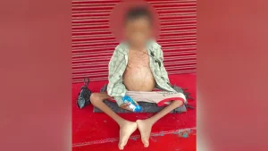 His family argues they took him for treatment to Umaria, Shahdol, Katni and Jabalpur in Madhya