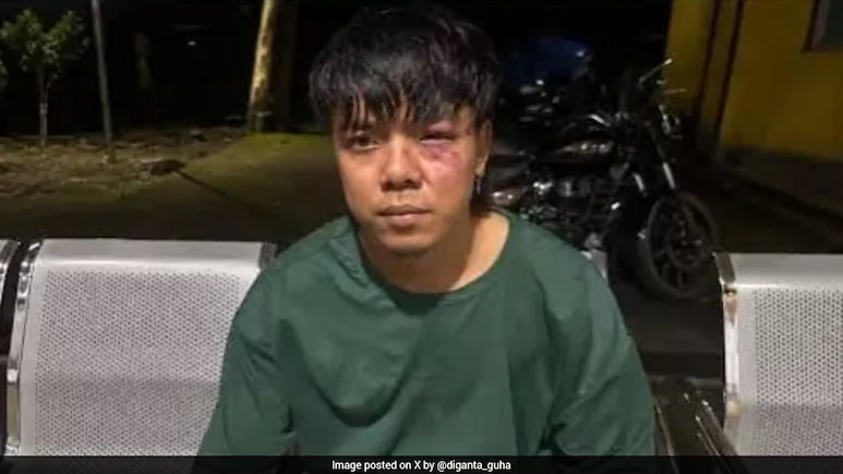 Sikkim-based rapper Ugen Namgyal Bhutia, popularly known as UNB, was allegedly attacked