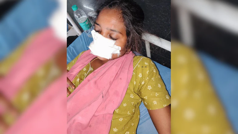 Telangana Man Bites Off Wife's Nose After She Refuses To Return Home