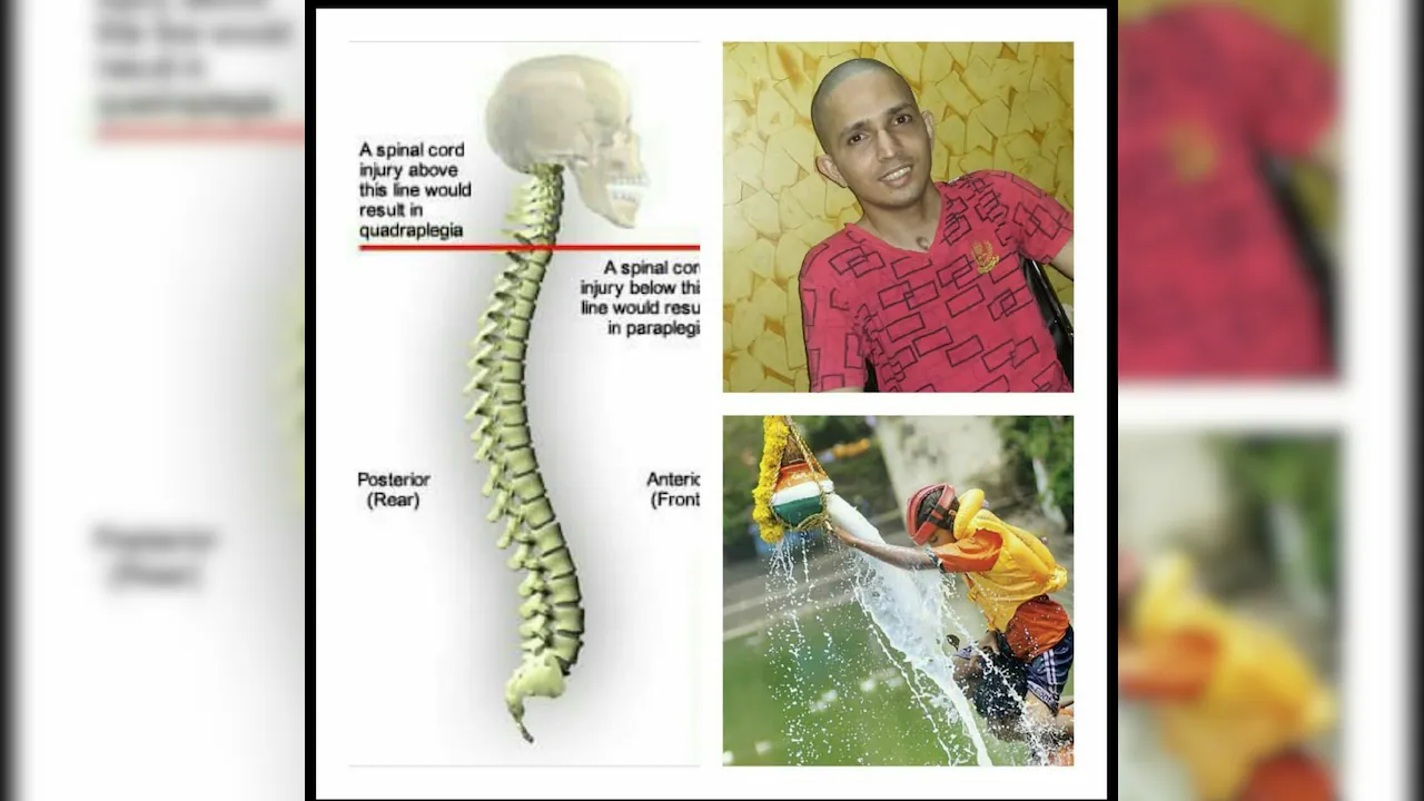 For Nagesh's mother, the past 17 years have meant watching her son struggle