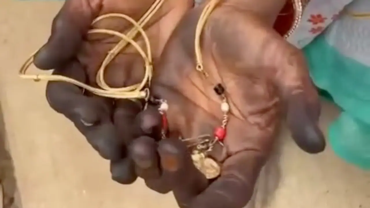 Woman showing her chain that alleged attackers tried to snatch Photo Credit: NDTV What followed